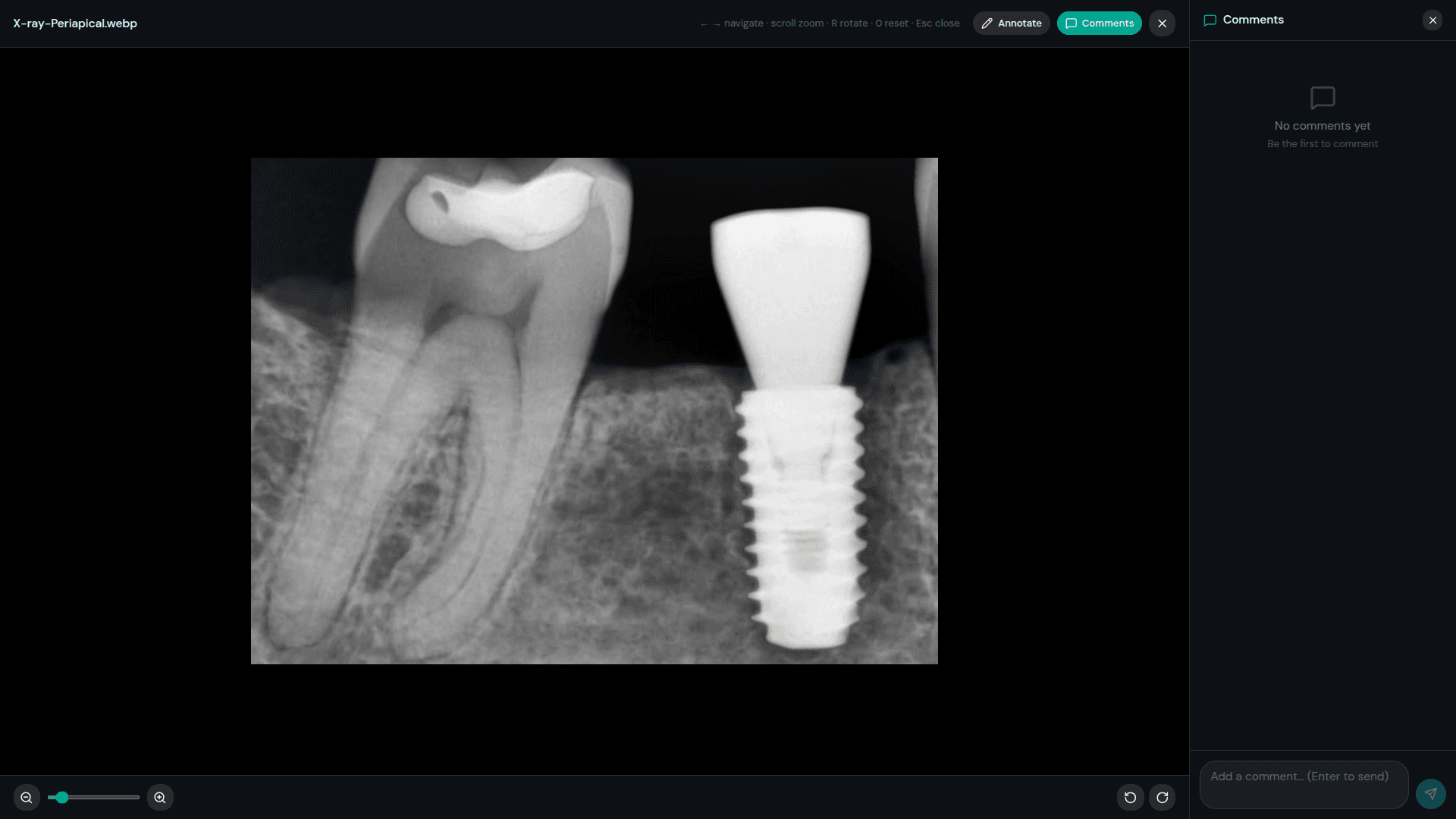 X-ray management with non-destructive annotation
