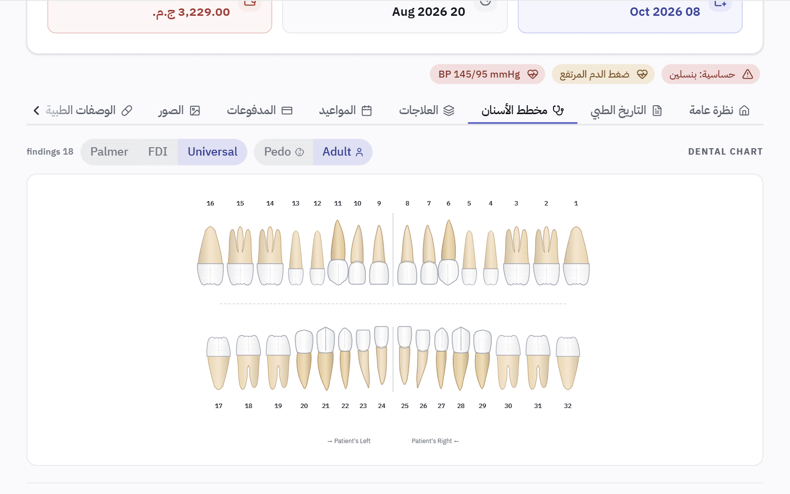 ملف مريض على تبويب مخطط الأسنان: تنبيه «حساسية: بنسلين» و«ضغط الدم المرتفع» فوق مخطط أسنان كامل، مع اختيار الترقيم Universal أو FDI أو Palmer.