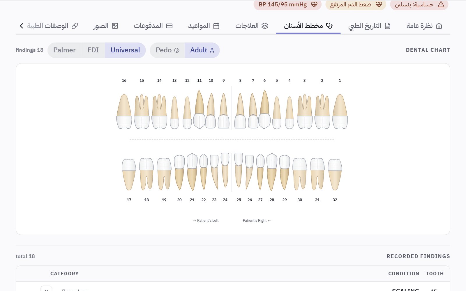 مخطط أسنان كامل مع اختيار أسنان الكبار أو الأطفال وترقيم Universal أو FDI أو Palmer، وتحته قائمة الملاحظات المسجّلة.